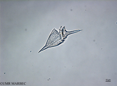 phyto/Brazilian_Nordeste/Northeastcoast_station36/ABRACOS1 October 2015/Oxytoxum subulatum (St36_270916160927_001_ovl-27)(copy)_thumb.jpg